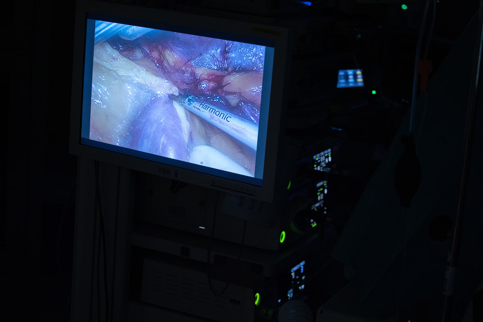 IKEM_Tx_ (11)-min.jpg